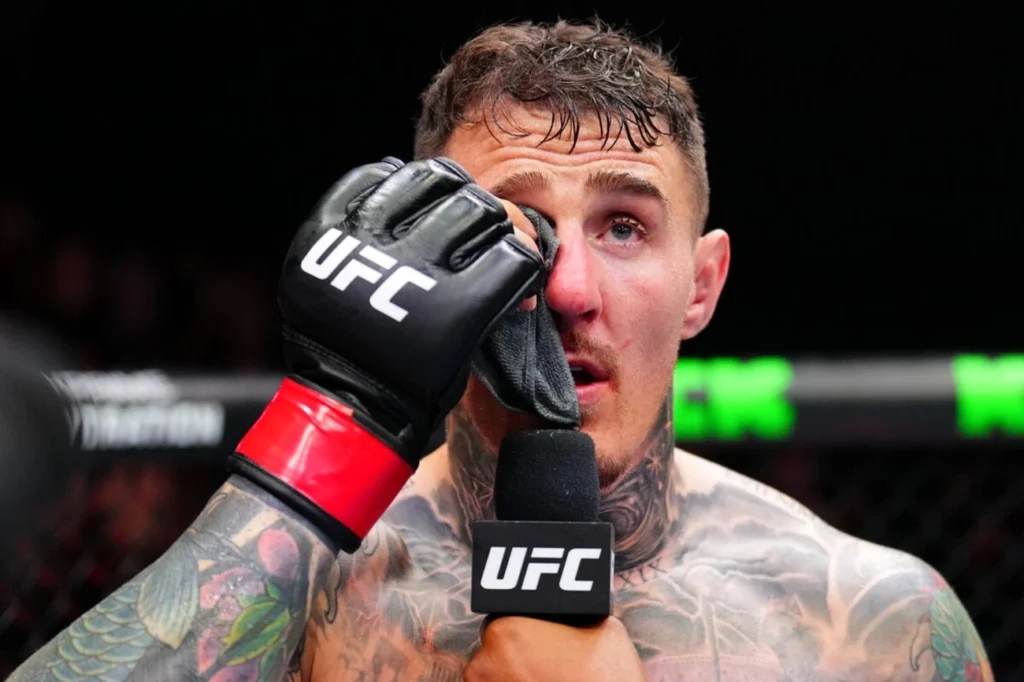 UFC: campeão que levou dedada no olho cita possibilidade de cirurgiaa UFC: campeão que levou dedada no olho cita possibilidade de cirurgiaa