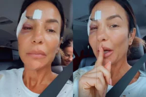 Ivete Sangalo atualiza saúde agora após desmaio e internação veja vídeo